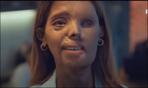 century ply acid attack ad?blur=25