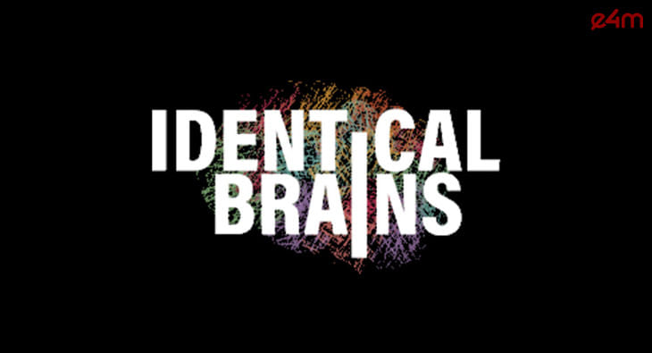 identical brains?blur=25