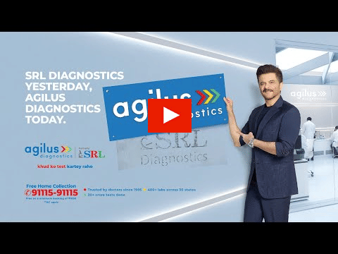 agilus?blur=25